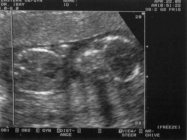 16weeks3