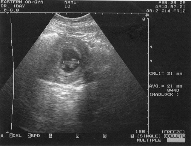 8weeks 1