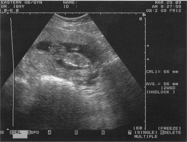babyturner1