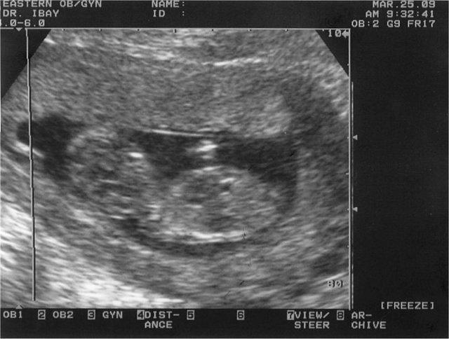 babyturner6